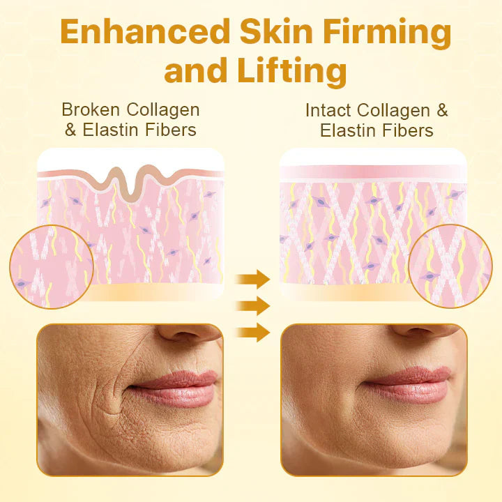 1 + 1 GRATIS HEUTE | BotoxLux™