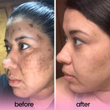 1 + 1 GRATIS HEUTE | GlowZest™ | Strahlendere Haut in nur einer Anwendung!