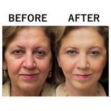 1 + 1 GRATIS HEUTE | HydraLift™