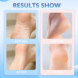 1 + 1 GRATIS HEUTE | NourishBalm™