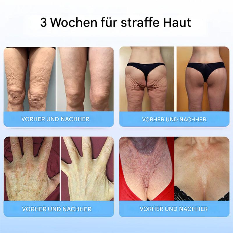 1+1 Gratis | Liftora™ Glättet und strafft Ihre Haut auf natürliche Weise