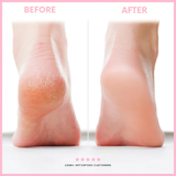 50% OFF TEMPORÄR | Elyssole™