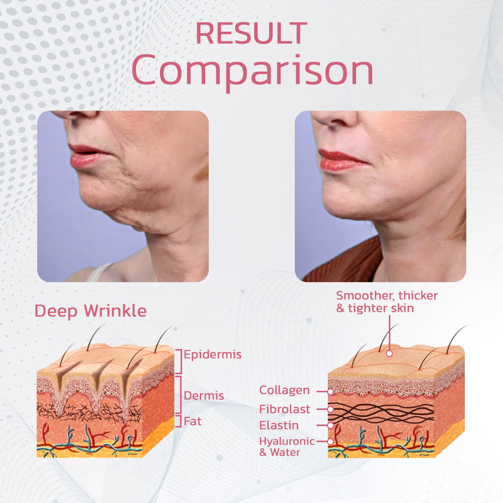 50% RABATT TEMPORÄR | Beautify™ - Säubern Sie Ihr Lymphsystem!