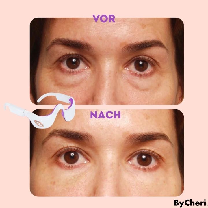 50% RABATT TEMPORÄR | RadianceEyes™ |Erleben Sie Augenmassage jederzeit und überall!