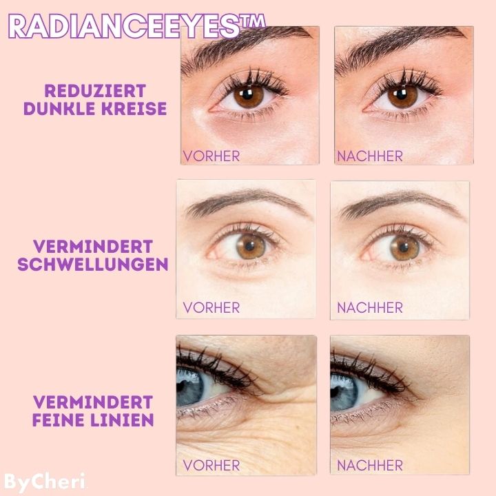 50% RABATT TEMPORÄR | RadianceEyes™ |Erleben Sie Augenmassage jederzeit und überall!