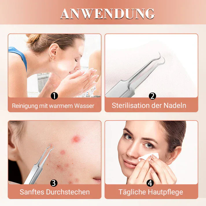 ClearSkin™ - Präzise Entfernung von Mitessern