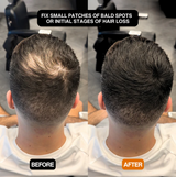 CoverEdge™ | Eine schnelle Lösung für einen natürlichen, voluminösen Haaransatz!