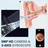 EarClear™ | Mühelose Entfernung von Ohrenschmalz mit Echtzeit-Visualisierung!