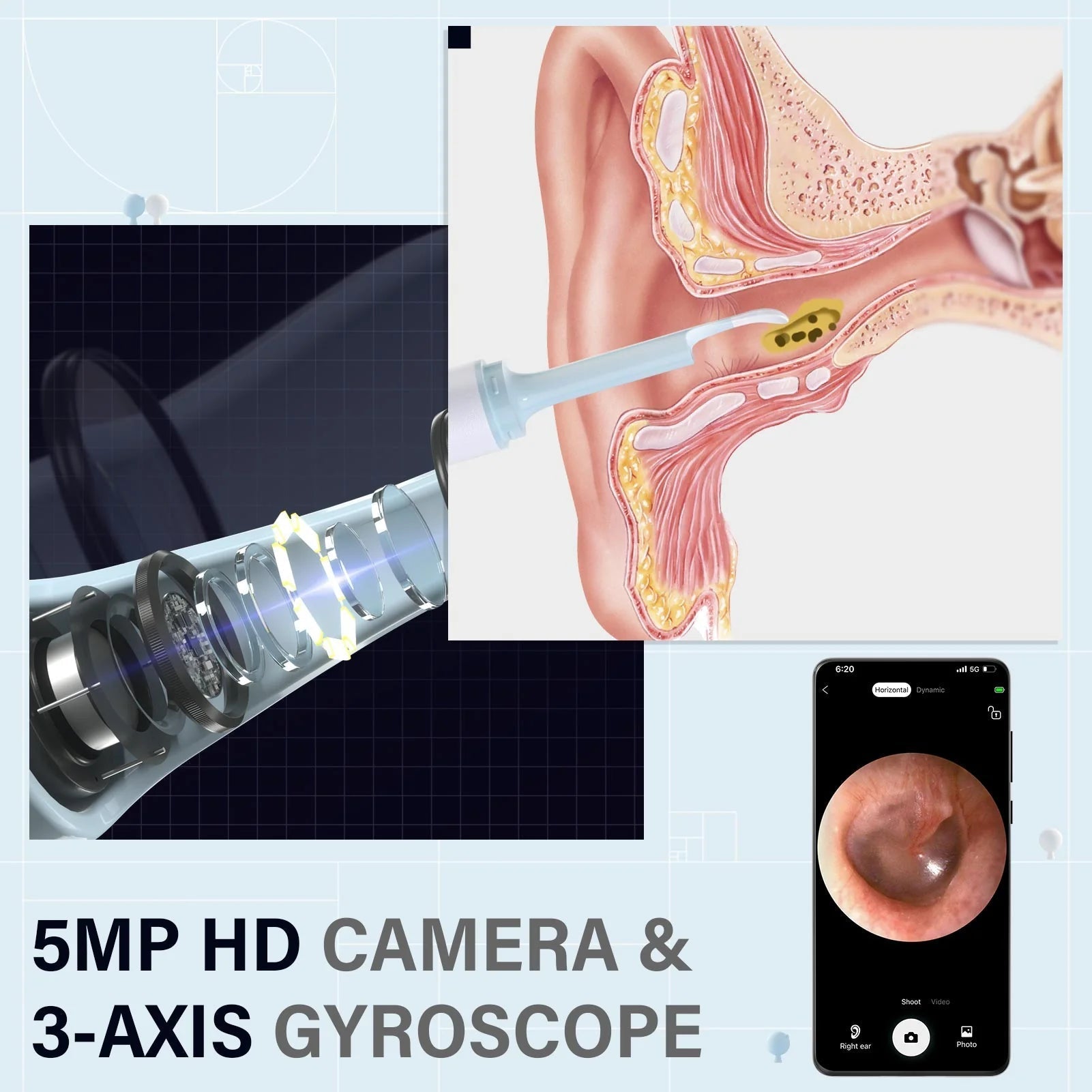 EarClear™ | Mühelose Entfernung von Ohrenschmalz mit Echtzeit-Visualisierung!