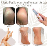 Elektrischer Hornhautentferner | Quarz-Kristallrollen | LED-Licht | Wasserdicht & Wiederaufladbar | CallusPro