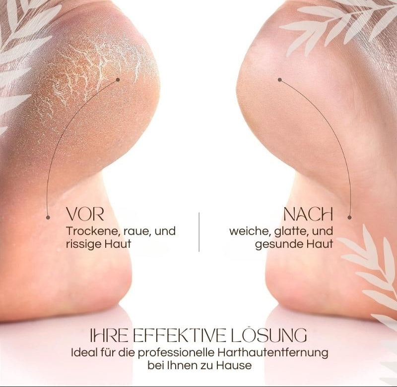 Elektrischer Hornhautentferner | Quarz-Kristallrollen | LED-Licht | Wasserdicht & Wiederaufladbar | CallusPro