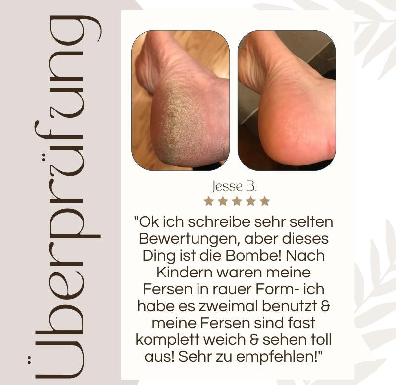 Elektrischer Hornhautentferner | Quarz-Kristallrollen | LED-Licht | Wasserdicht & Wiederaufladbar | CallusPro