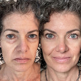 EyeRevive™ | Verabschieden Sie sich von Augenringen und Schwellungen!