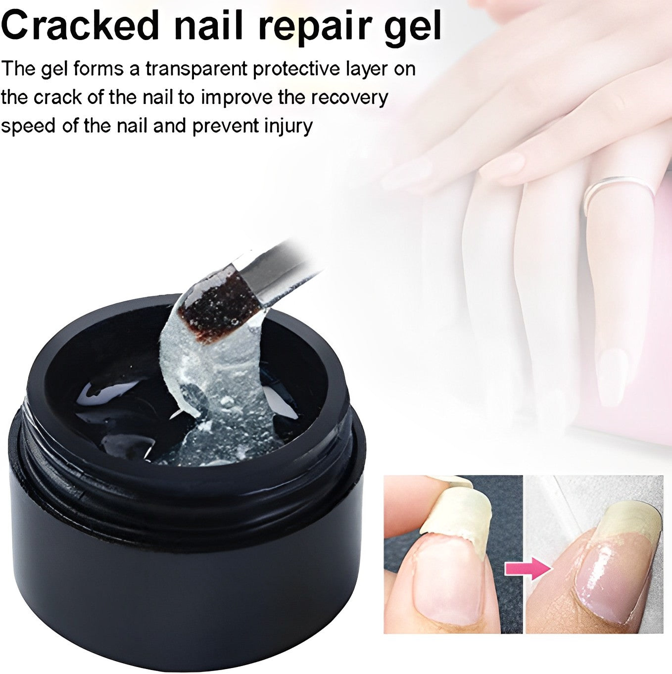 FavNail™ - Repair your broken nails