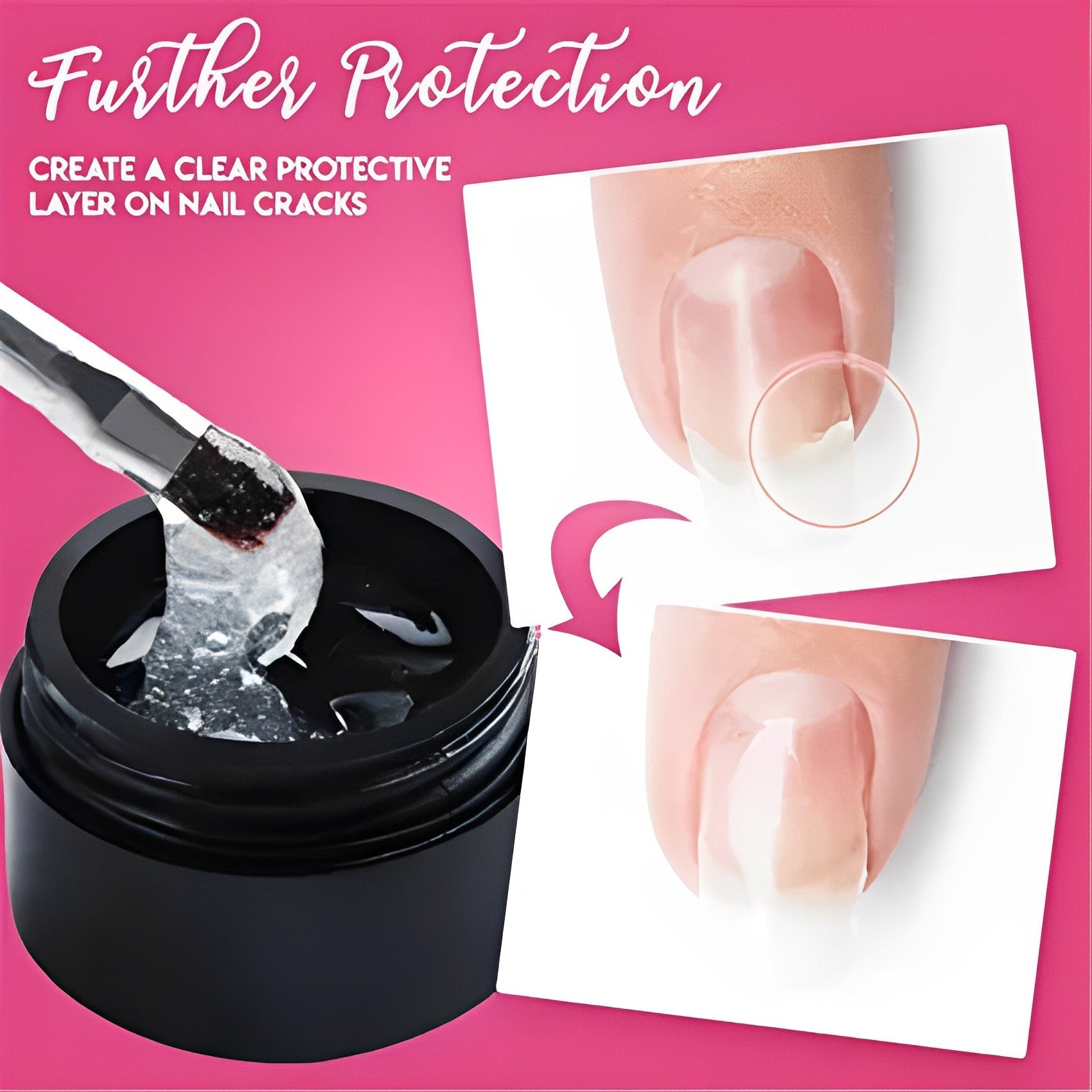 FavNail™ - Repair your broken nails