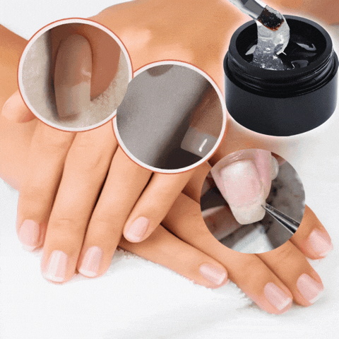 FavNail™ - Repair your broken nails