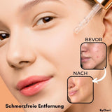 FlawlessFade™ | Verabschieden Sie sich von Hautunreinheiten