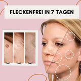 FlawlessFade™ | Verabschieden Sie sich von Hautunreinheiten
