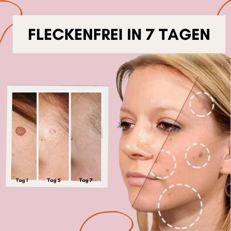 FlawlessFade™ | Verabschieden Sie sich von Hautunreinheiten