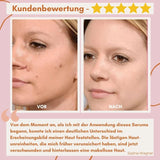 FlawlessFade™ | Verabschieden Sie sich von Hautunreinheiten