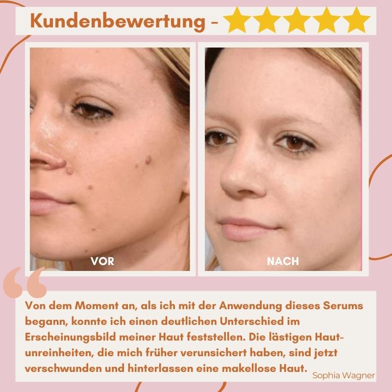 FlawlessFade™ | Verabschieden Sie sich von Hautunreinheiten