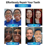 Futusly™ - Die preiswerte und einfache Lösung für Ihre Zahnprobleme