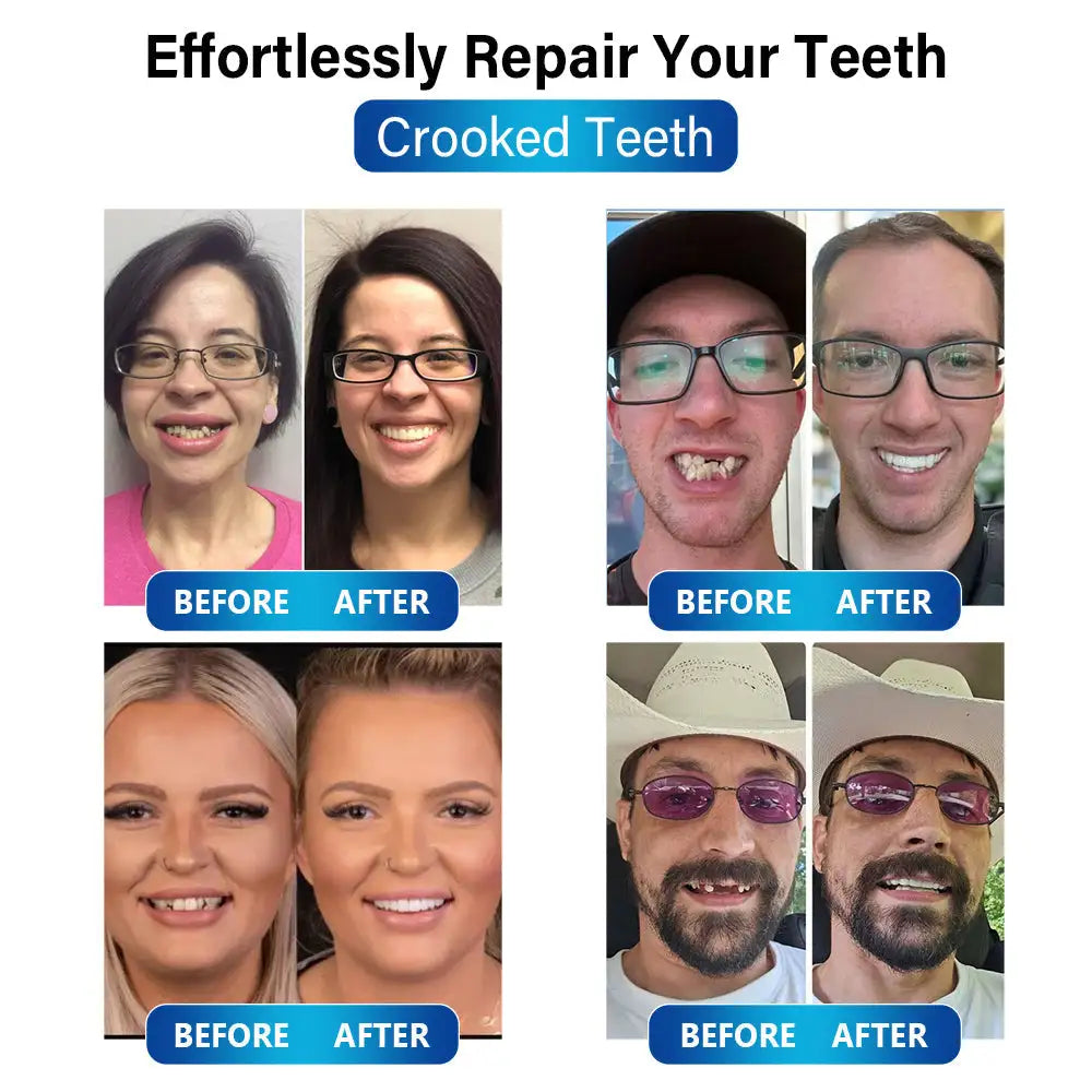 Futusly™ - Die preiswerte und einfache Lösung für Ihre Zahnprobleme