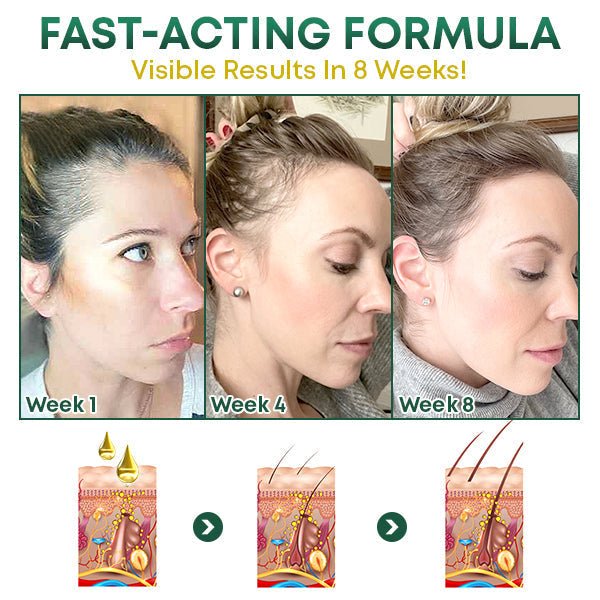 HairGrowth™ - Volleres Haar auf natürliche Weise