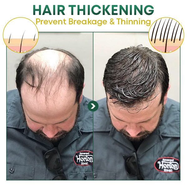 HairGrowth™ - Volleres Haar auf natürliche Weise