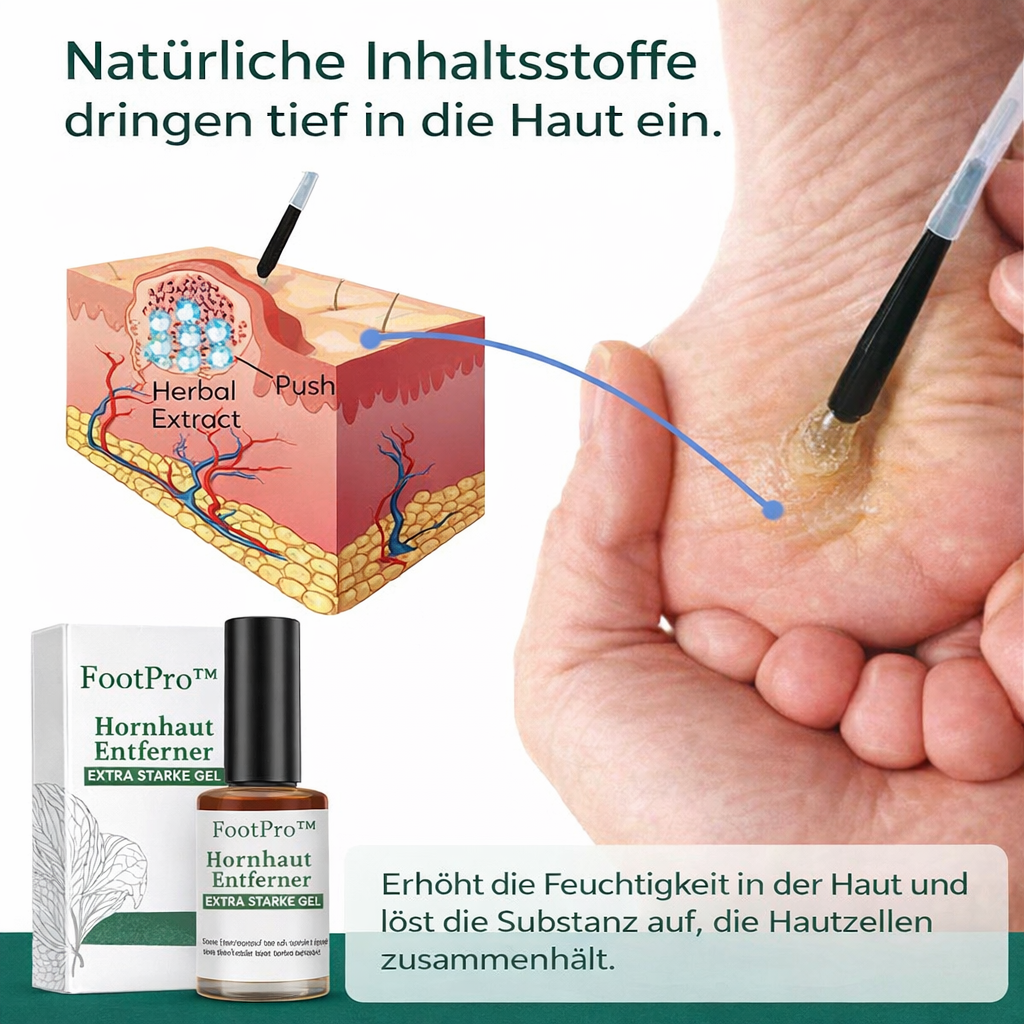 Hühneraugenentferner Gel | Extra Stark & Schmerzfrei | FootPro