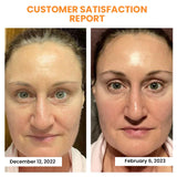 HydraLuxe™ | Koreanische Dermalayr-Technologie Löslicher Kollagenfilm