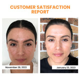 HydraLuxe™ | Koreanische Dermalayr-Technologie Löslicher Kollagenfilm