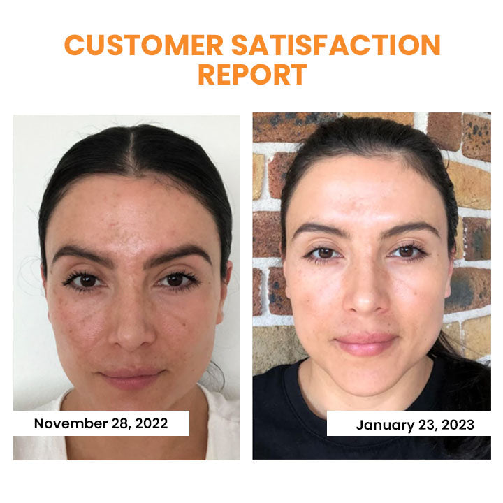 HydraLuxe™ | Koreanische Dermalayr-Technologie Löslicher Kollagenfilm