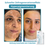 Klara™ Schmerzfreier Laser-Stift — Enthülle jederzeit makellose Haut und Selbstvertrauen