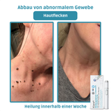Klara™ Schmerzfreier Laser-Stift — Enthülle jederzeit makellose Haut und Selbstvertrauen