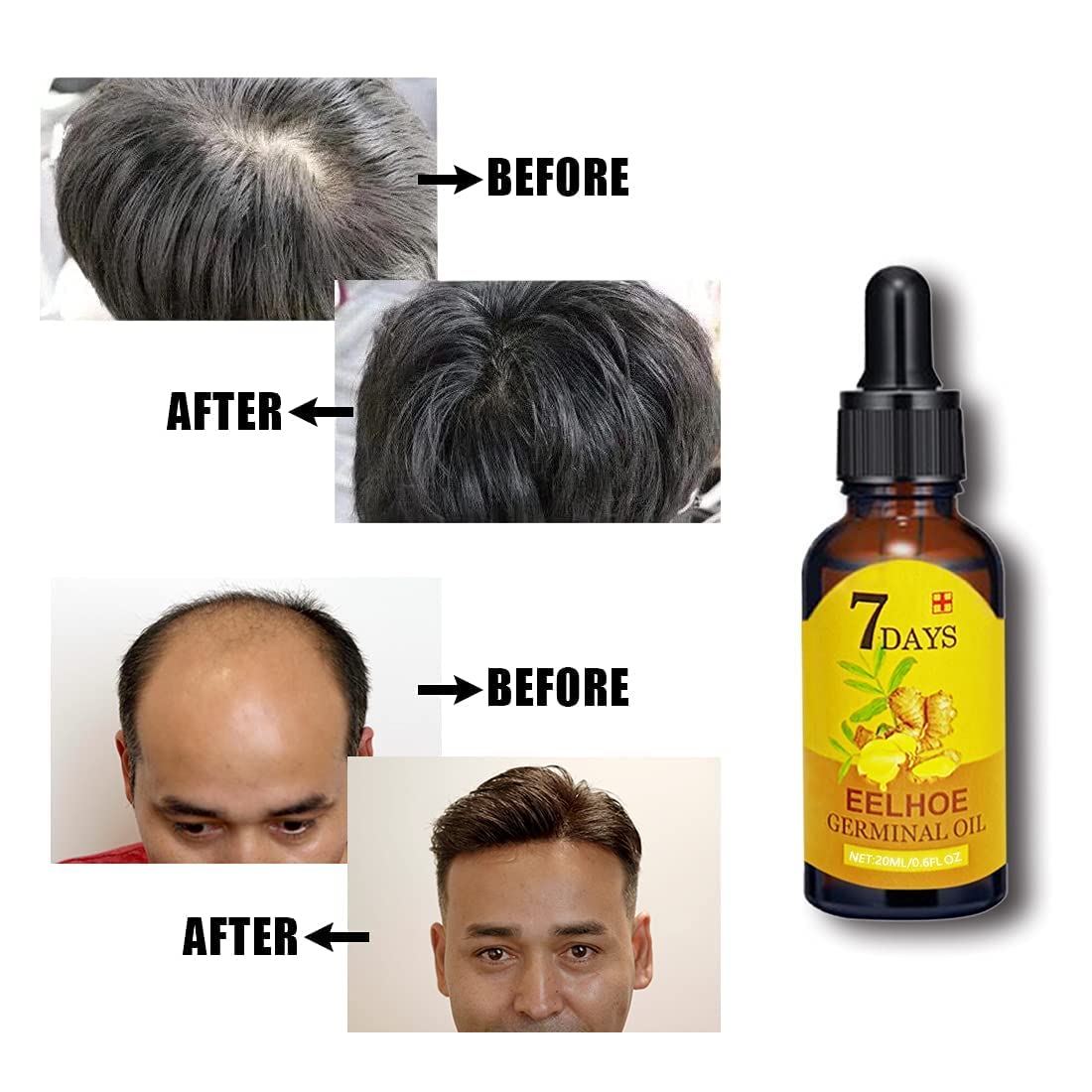 LuxOil Haarwuchs Serum | 7-Tage-Germinal-Technologie | Gegen Haarausfall | 1+1 Gratis