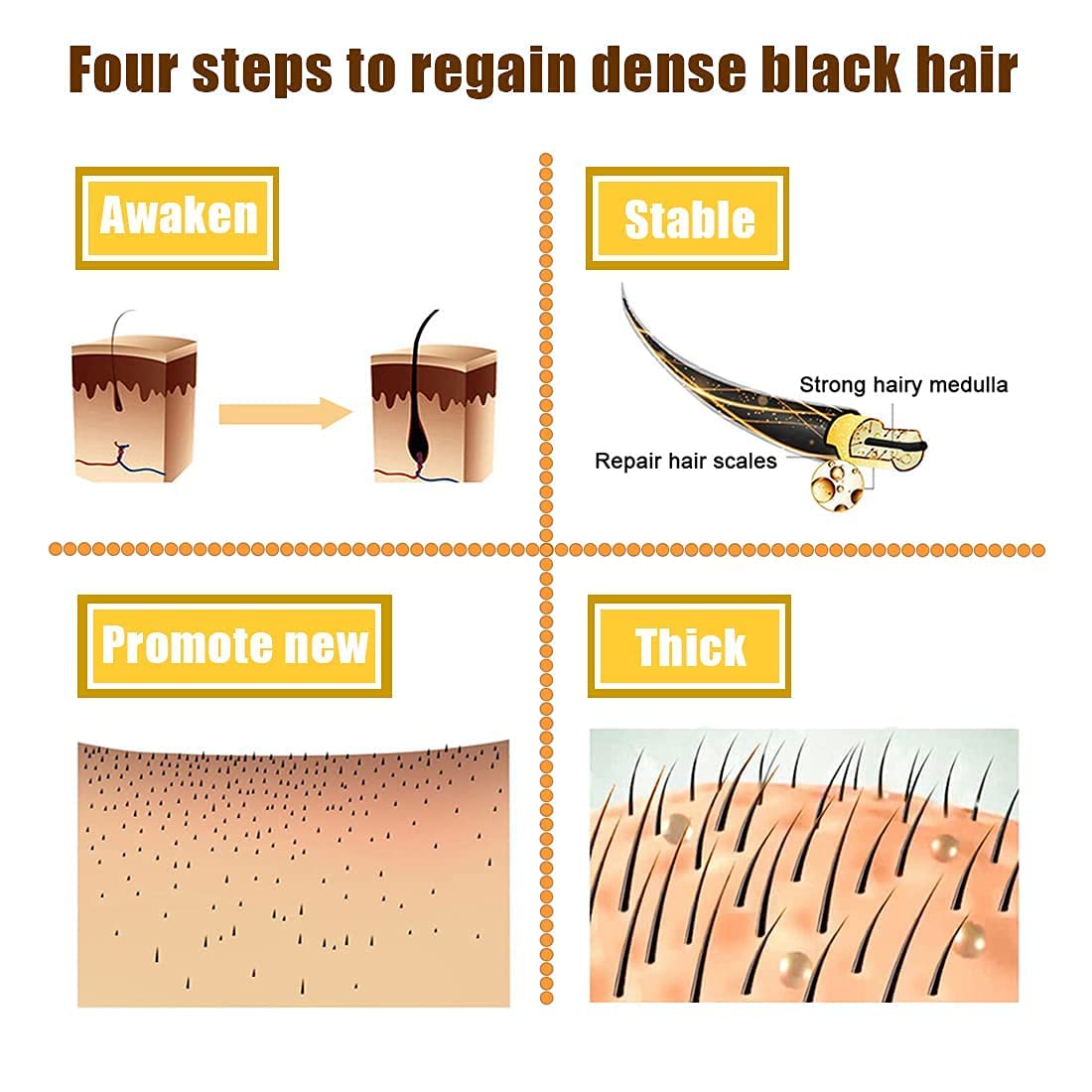 LuxOil Haarwuchs Serum | 7-Tage-Germinal-Technologie | Gegen Haarausfall | 1+1 Gratis