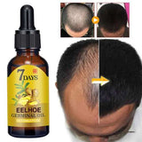 LuxOil Haarwuchs Serum | 7-Tage-Germinal-Technologie | Gegen Haarausfall | 1+1 Gratis