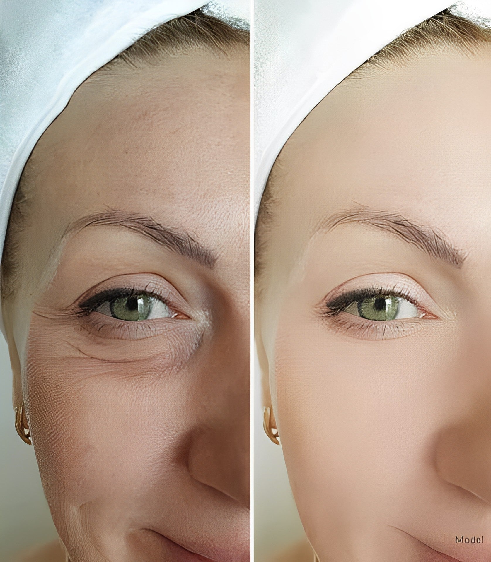 MagicSerum™ - Macht die Haut glatter und jünger