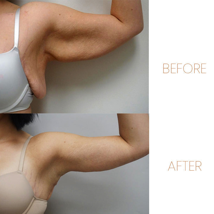 Magnetischer Akupressur Ring | Magnettherapie | Stoffwechsel-Aktivierung | 1+1 Gratis| MagneticTherapy