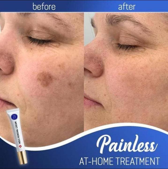 Miracle Cream™ - Erhalten Sie eine strahlende Haut