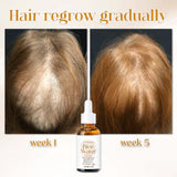 PoreAid™| Japanisches fermentiertes Reiswasser Haarserum