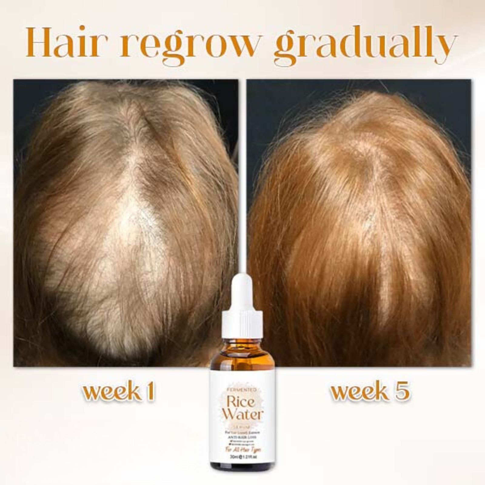 PoreAid™| Japanisches fermentiertes Reiswasser Haarserum