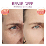 PrettyGlow™- Verjüngen Sie Ihre Augen!