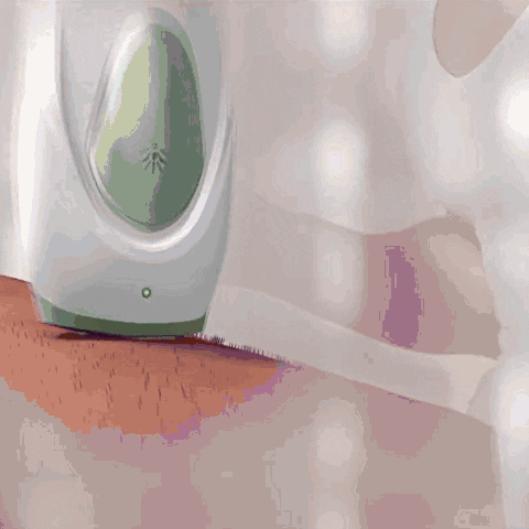 Radiance™ - Schmerzloser IPL-Laser-Haarentferner