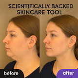 RadiantWand™ | Straffen, festigen und verjüngen Sie Ihre Haut im Handumdrehen!