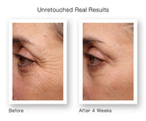 Retinol Anti-Aging-Serum