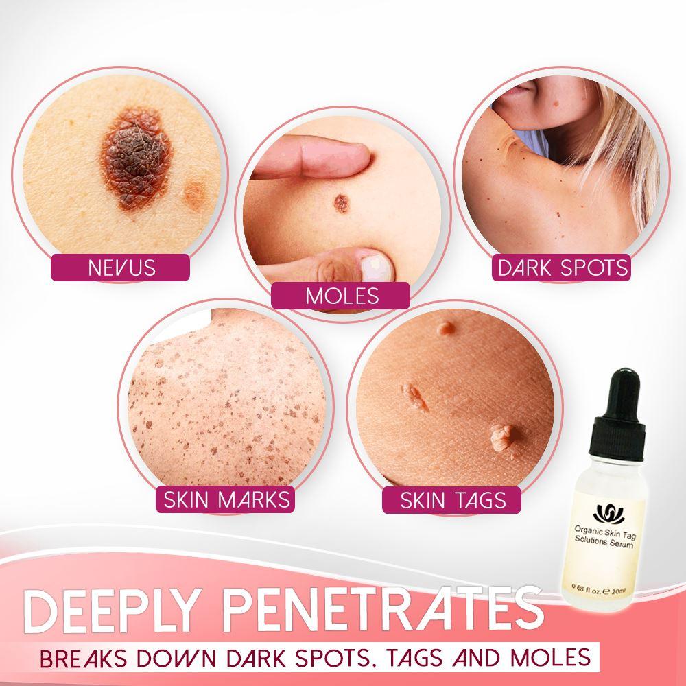 Spotless Skin Serum™-Organisches Serum zur Lösung von Hautflecken