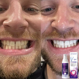 V34-CleanTeeth™- Farbkorrigierende Zahnpasta!