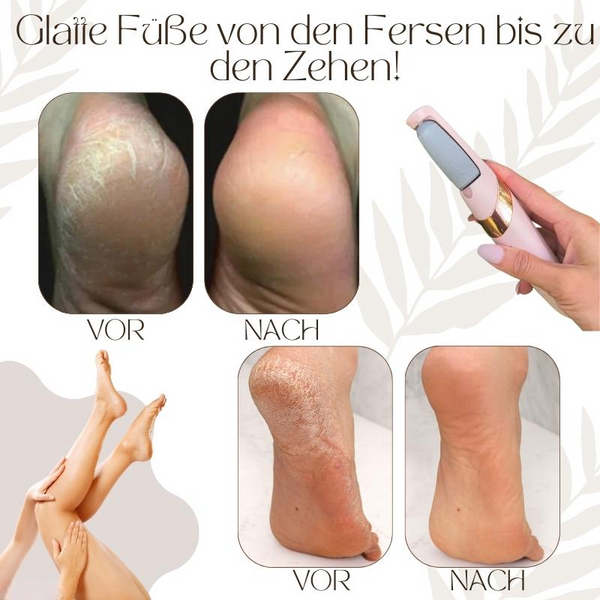 VelvetStep™ — Entdecke babyzarte Füße, die du gerne zeigst